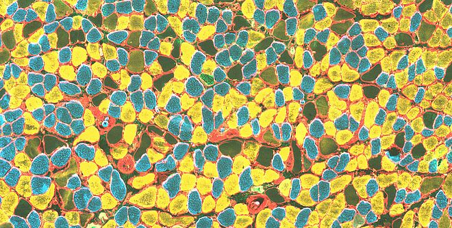 Muscle cross section