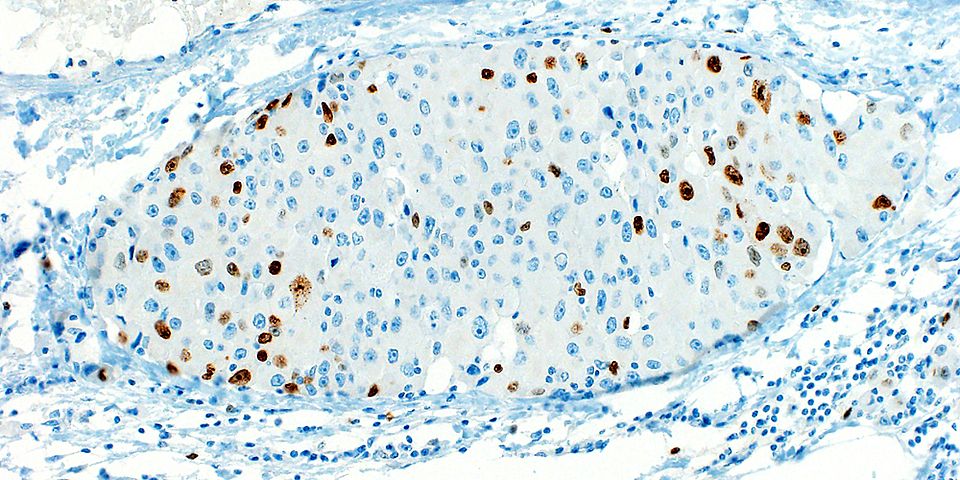 Expression of the long Argonaute 1 protein