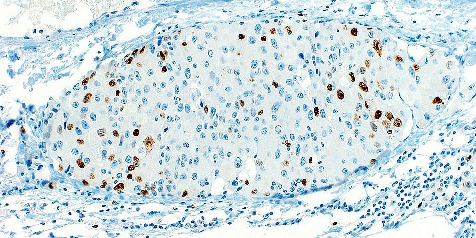 Expression of the long Argonaute 1 protein 